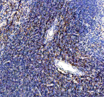 Immunohistochemical staining of FFPE mouse spleen tissue with CD80 antibody, HRP-secondary and DAB substrate. HIER: boil tissue sections in pH8 EDTA for 20 min and allow to cool before testing.