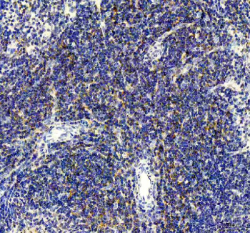 Immunohistochemical staining of FFPE rat spleen tissue with CD80 antibody, HRP-secondary and DAB substrate. HIER: boil tissue sections in pH8 EDTA for 20 min and allow to cool before testing.