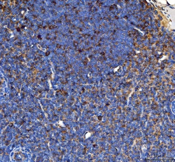 Immunohistochemical staining of FFPE rat lymph node tissue with CD80 antibody, HRP-secondary and DAB substrate. HIER: boil tissue sections in pH8 EDTA for 20 min and allow to cool before testing.