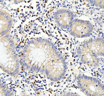 Immunohistochemical staining of FFPE human appendix tissue with CD80 antibody, HRP-secondary and DAB substrate. HIER: boil tissue sections in pH8 EDTA for 20 min and allow to cool before testing.
