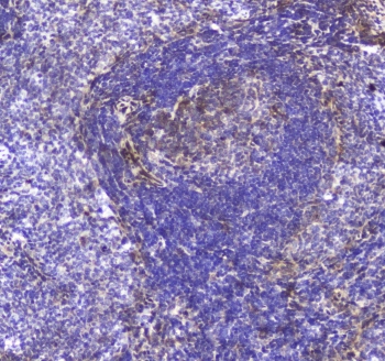 IHC testing of FFPE rat spleen tissue with TLR1 antibody at 1ug/ml. Required HIER: steam section in pH6 citrate buffer for 20 min and allow to cool prior to staining.