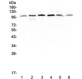 MVP Antibody Human Sample WB. Western blot analysis of Major Vault Protein (MVP / LRP) expression in human samples using a rabbit polyclonal MVP antibody. Lane 1: placenta lysate, Lane 2: HepG2 lysate, Lane 3: A549 lysate, Lane 4: PANC-1 lysate, Lane 5: SGC-7901 lysate, Lane 6: MDA-MB-231 lysate. A strong band is detected at approximately 104-110 kDa, consistent with the predicted molecular weight of Major vault protein (MVP). The band is observed across multiple epithelial-derived cell lines and tissue lysate, aligning with the known widespread expression of MVP and its role as a core component of vault complexes associated with drug resistance and cellular stress response pathways.