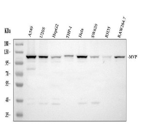 MVP Antibody for WB Human, Rat and Mouse WB. Western blot analysis of lane 1: human A549, lane 2: human U2OS, lane 3: human HepG2, lane 4: human THP-1, lane 5: human HeLa, lane 6: human SW620, lane 7: rat RH35, and lane 8: mouse RAW264.7 cell lysates using MVP Antibody for WB / Major Vault Protein Western Blot Antibody at 0.5 ug/ml. A specific band is detected at approximately 100-110 kDa, consistent with the expected molecular weight of the 99 kDa Major Vault Protein. This MVP Antibody for WB, also called Major Vault Protein Western Blot Antibody, is suitable for Western blot studies of vault ribonucleoprotein complexes, multidrug resistance, intracellular transport, and Major Vault Protein expression across multiple species.