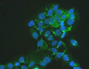 MVP Antibody IF/ICC. Immunofluorescence staining of FFPE human A431 cells with MVP antibody (green) at 2ug/ml and DAPI nuclear stain (blue). HIER: steam section in pH6 citrate buffer for 20 min.