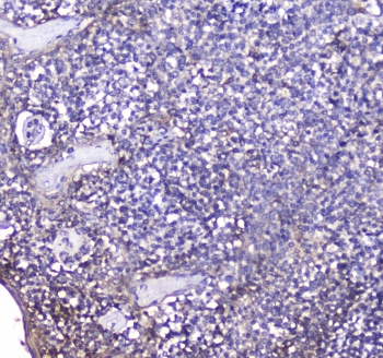 IHC testing of FFPE human tonsil tissue with BCMA antibody. HIER: boil tissue sections in pH6, 10mM citrate buffer, for 10-20 min followed by cooling at RT for 20 min.