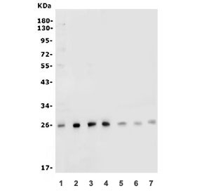 Western blot testing of human 1) PC-3, 2) HEK293, 3) MCF7, 4) ThP-1, 5) rat pancreas, 6) rat lung and 7) mouse pancreas lysate with CLPP antibody at 0.5ug/ml. Predicted molecular weight: 26-30 kDa.