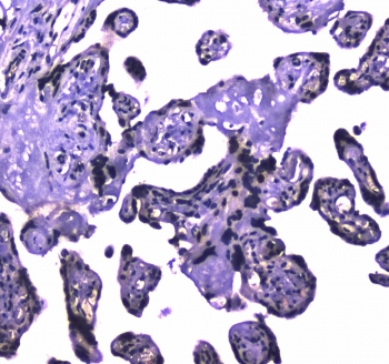 IHC testing of FFPE human placental tissue with USP7 antibody at 1ug/ml. Required HIER: steam section in pH6 citrate buffer for 20 min and allow to cool prior to staining.