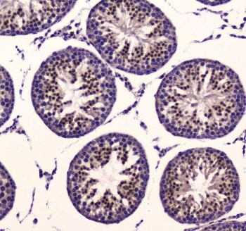 IHC testing of FFPE rat testis tissue with PDK1 antibody at 1ug/ml. Required HIER: steam section in pH6 citrate buffer for 20 min and allow to cool prior to staining.