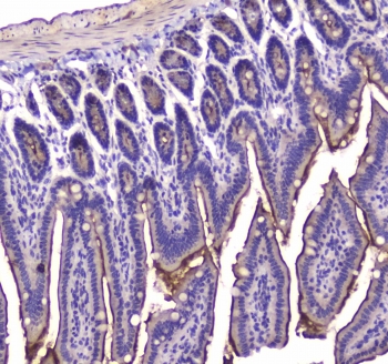 IHC testing of FFPE mouse small intestine tissue with CB1 antibody at 1ug/ml. Required HIER: steam section in pH6 citrate buffer for 20 min and allow to cool prior to staining.