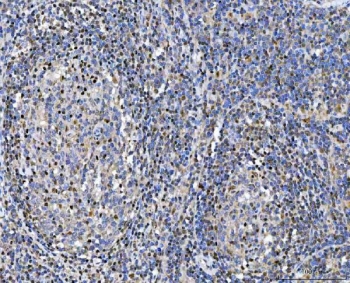 IHC staining of FFPE human tonsil tissue with Glutathione Reductase antibody. HIER: boil tissue sections in pH8 EDTA for 20 min and allow to cool before testing.