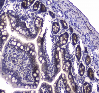 IHC testing of FFPE rat small intestine tissue with PARN antibody at 1ug/ml. Required HIER: steam section in pH6 citrate buffer for 20 min and allow to cool prior to staining.