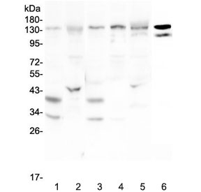 Western blot testing of rat 1) brain, 2) liver and mouse 3) brain, 4) spleen, 5) liver and 6) testis lysate with EPS15 antibody at 0.5ug/ml. Predicted molecular weight ~99 kDa, routinely observed at 120-150 kDa.