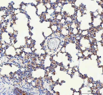 Immunohistochemistry of VE Cadherin / Cadherin 5 in mouse lung tissue. Formalin-fixed, paraffin-embedded mouse lung tissue stained with VE Cadherin antibody shows membranous staining in endothelial cells lining alveolar capillaries and small blood vessels, with minimal signal in surrounding alveolar epithelial cells and interstitial tissue. Antigen retrieval was performed by boiling tissue sections in EDTA buffer, pH 8.0, for 20 minutes, followed by cooling prior to immunostaining.