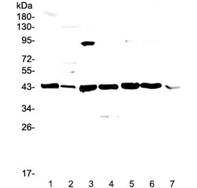 Western blot testing of mouse 1) liver, 2) testis, 3) thymus, 4) lung, 5) HEPA1-6, 6) NIH3T3 and 7) SP20 lysate with Caspase 4 antibody at 0.5ug/ml. Expected molecular weight ~43 kDa (precursor), ~30 kDa (pro domain + large subunit), ~20 kDa (large subunit).