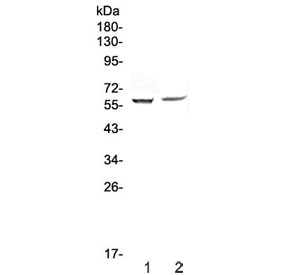 Western blot testing of human 1) HepG2 and 2) PANC-1 cell lysate with STAM1 antibody at 0.5ug/ml. Predicted molecular weight ~59 kDa.