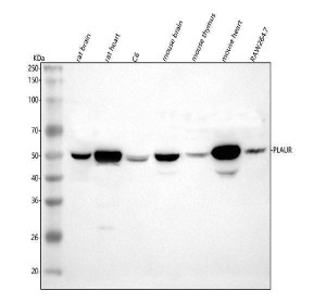 uPAR Antibody Mouse and Rat Tissue WB. Western blot analysis of rat brain, rat heart, rat C6, mouse brain, mouse thymus, mouse heart, and mouse RAW264.7 lysates using uPAR Antibody at 0.5 ug/ml. An HRP-conjugated secondary antibody with ECL substrate was used for detection. uPAR Antibody, a Cell Invasion Receptor Antibody, detects a prominent band at approximately 50 kDa across multiple rat and mouse samples, consistent with the glycosylated form of PLAUR/uPA receptor. The higher observed molecular weight compared to the predicted 36 kDa core protein is consistent with extensive post-translational glycosylation of uPAR.