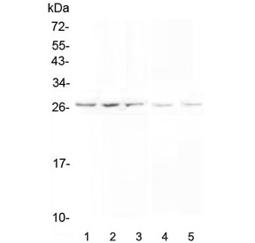 Western blot testing of 1) human PANC-1, 2) human SGC-7901, 3) human A549, 4) rat testis and 5) mouse testis lysate with VAPB antibody at 0.5ug/ml. Predicted molecular weight ~27 kDa.