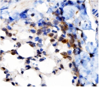 IHC staining of FFPE mouse lung with VAPB antibody. HIER: boil tissue sections in pH8 EDTA for 20 min and allow to cool before testing.