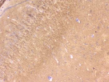 IHC testing of FFPE mouse brain with RKIP antibody at 1ug/ml. HIER: boil tissue sections in pH6, 10mM citrate buffer, for 10-20 min followed by cooling at RT for 20 min.
