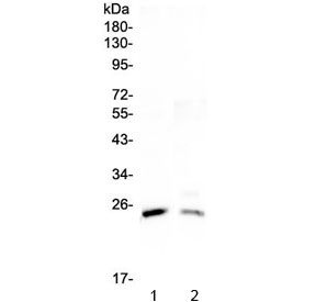 StAR Antibody for WB. Western blot analysis of Steroidogenic Acute Regulatory Protein (StAR / STARD1) using a rabbit polyclonal antibody in 1) rat testis lysate and 2) mouse testis lysate. A band is detected at approximately 30 kDa, consistent with the mature mitochondrial form of StAR following cleavage of the N-terminal targeting sequence. The predicted molecular weight of the StAR preprotein is approximately 37 kDa, while mitochondrial processing produces a mature form of about 30 kDa commonly observed in western blot analysis of steroidogenic tissues.