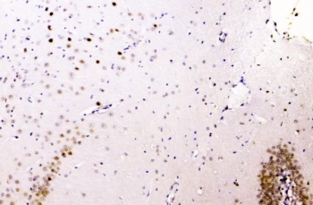 IHC staining of FFPE rat brain with HNRNPA2B1 antibody. HIER: boil tissue sections in pH8 EDTA for 20 min and allow to cool before testing.