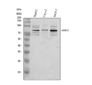 RNF43 Antibody Human Liver and Colon Cancer Cell WB. Western blot analysis using RNF43 Antibody. Lane 1: human HepG2 cells; Lane 2: human Caco-2 cells; Lane 3: human MCF-7 cells. A prominent band is detected at approximately 86 kDa in each lysate, matching the expected molecular weight of RNF43. Detection in hepatocellular carcinoma, colorectal adenocarcinoma and breast adenocarcinoma cell lines demonstrates RNF43 expression across diverse epithelial cancer models commonly used to investigate Wnt signaling and receptor regulation. These results support the use of RNF43 Antibody / Wnt Signaling Regulator Antibody for studying RNF43 expression, Frizzled receptor ubiquitination and Wnt pathway regulation.