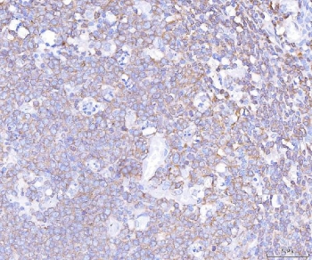 IHC staining of FFPE human tonsil tissue with PLCG2 antibody. HIER: boil tissue sections in pH8 EDTA for 20 min and allow to cool before testing.