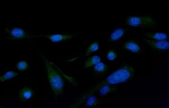 Immunofluorescent staining of FFPE human U-2 OS cells with PLCG2 antibody (green) and DAPI nuclear stain (blue). HIER: steam section in pH6 citrate buffer for 20 min.