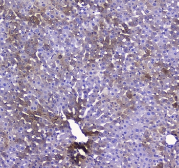 IHC testing of FFPE rat liver tissue with COX4I1 antibody at 1ug/ml. Required HIER: steam section in pH6 citrate buffer for 20 min and allow to cool prior to staining.
