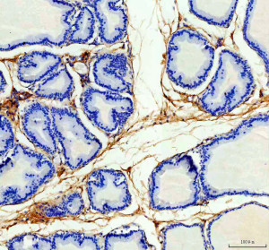 OIF Antibody by IHC in Rat Bladder. Immunohistochemistry of paraffin-embedded rat bladder sections using OIF Antibody. Strong extracellular and stromal staining is visible around glandular and epithelial structures, while the epithelial cells themselves show substantially less labeling. The Osteoinductive Factor Polyclonal Antibody demonstrates prominent OGN localization within the supporting connective tissue and extracellular matrix surrounding these structures, with little nuclear staining.