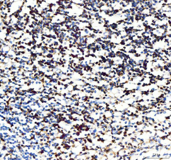 IHC staining of FFPE human appendix tissue with CD5 antibody, HRP-secondary and DAB substrate. HIER: boil tissue sections in pH8 EDTA for 20 min and allow to cool before testing.