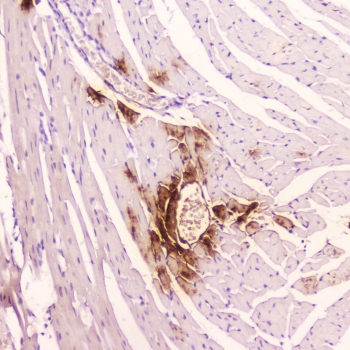 ANF Antibody Mouse Heart IHC. Immunohistochemistry staining of FFPE mouse heart tissue using ANF antibody demonstrates localized cytoplasmic staining within cardiac-associated cell populations, consistent with expression of Atrial Natriuretic Factor (ANF/ANP). ANF is a cardiac-derived peptide hormone encoded by the NPPA gene that functions as an important regulator of cardiovascular homeostasis, fluid balance, and endocrine signaling. The observed staining pattern is consistent with the role of ANF-producing cardiac cells in natriuretic peptide-mediated regulation of circulatory physiology. These findings support the utility of ANF antibody for studies of cardiac hormone biology, cardiovascular signaling, and endocrine regulation. HIER: boil tissue sections in pH6 10mM citrate buffer for 10-20 min followed by cooling at room temperature for 20 min.
