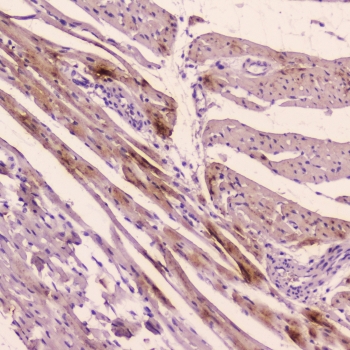 ANF Antibody Rat Heart IHC. Immunohistochemistry staining of FFPE rat heart tissue using ANF antibody demonstrates cytoplasmic staining within cardiac muscle and cardiac-associated cellular structures, consistent with expression of Atrial Natriuretic Factor (ANF/ANP). ANF is a peptide hormone encoded by the NPPA gene and serves as an important regulator of cardiovascular homeostasis, fluid balance, and natriuretic peptide signaling. The observed staining pattern is consistent with the established role of cardiac tissue as a major site of ANF production and endocrine regulation. These findings support the utility of ANF antibody for studies of cardiac hormone biology, cardiovascular signaling pathways, and endocrine function. HIER: boil tissue sections in pH6 10mM citrate buffer for 10-20 min followed by cooling at room temperature for 20 min.