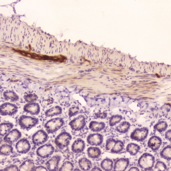 ANF Antibody Rat Small Intestine IHC. Immunohistochemistry staining of FFPE rat small intestine tissue using ANF antibody demonstrates localized staining within scattered cellular and submucosal-associated structures, consistent with expression of Atrial Natriuretic Factor (ANF/ANP). ANF is a peptide hormone encoded by the NPPA gene that functions as a key regulator of cardiovascular homeostasis, fluid balance, and endocrine signaling. In addition to its well-established cardiac expression, natriuretic peptide signaling components are present in multiple tissue types where they may contribute to local regulatory and homeostatic processes. These findings support the utility of ANF antibody for studies of peptide hormone expression, endocrine communication, and natriuretic peptide biology. HIER: boil tissue sections in pH6 10mM citrate buffer for 10-20 min followed by cooling at room temperature for 20 min.