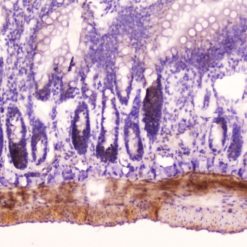 ANP Antibody Rat Small Intestine IHC. Immunohistochemistry staining of FFPE rat small intestine tissue using ANP antibody demonstrates localized staining within submucosal and stromal-associated cellular structures, consistent with expression of Atrial Natriuretic Peptide (ANP/ANF). ANP is a peptide hormone encoded by the NPPA gene that functions as an important regulator of cardiovascular homeostasis, fluid balance, and endocrine signaling. While ANP is most prominently associated with cardiac tissue, natriuretic peptide signaling components are also present in extra-cardiac tissues where they may participate in local regulatory and homeostatic processes. These findings support the utility of ANP antibody for studies of peptide hormone expression, endocrine communication, and natriuretic peptide biology. HIER: boil tissue sections in pH6 10mM citrate buffer for 10-20 min followed by cooling at room temperature for 20 min.