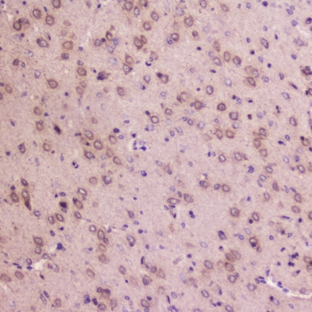 IHC testing of FFPE rat brain tissue with IGFBP2 antibody at 2ug/ml. HIER: boil tissue sections in pH6, 10mM citrate buffer, for 10-20 min followed by cooling at RT for 20 min.