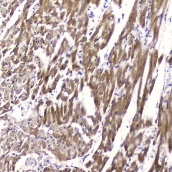 FABP3 Antibody Rat Cardiac Tissue IHC. Immunohistochemistry testing of FFPE rat heart tissue with FABP3 antibody at 2ug/ml. HIER: boil tissue sections in pH6, 10mM citrate buffer, for 10-20 min followed by cooling at RT for 20 min.