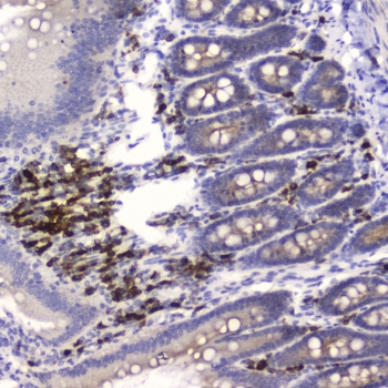 HE4 Antibody Rat Small Intestine IHC. Immunohistochemistry was performed on FFPE rat small intestine tissue using HE4 Antibody at 0.5 ug/mL. Heat-induced epitope retrieval was carried out in pH 6 citrate buffer for 10-20 minutes, followed by cooling to room temperature before incubation with the primary antibody. Bound antibody was visualized using an HRP-conjugated secondary antibody and DAB chromogen. Distinct cytoplasmic staining is observed in cells within the intestinal tissue, consistent with HE4 expression, while surrounding tissue shows minimal background staining. These results demonstrate that this Human Epididymis Protein 4 Antibody is suitable for detecting HE4 in formalin-fixed, paraffin-embedded rat tissue by immunohistochemistry.
