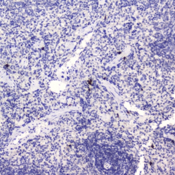 HE4 Antibody Rat Spleen IHC. Immunohistochemistry was performed on FFPE rat spleen tissue using HE4 Antibody at 0.5 ug/mL. Heat-induced epitope retrieval was carried out in pH 6 citrate buffer for 10-20 minutes, followed by cooling to room temperature before incubation with the primary antibody. Bound antibody was visualized using an HRP-conjugated secondary antibody and DAB chromogen. Distinct staining is observed in a limited population of splenic cells, while the majority of surrounding tissue remains negative, demonstrating selective HE4 expression with low background. These results support the use of this Human Epididymis Protein 4 Antibody for immunohistochemical detection of HE4 in formalin-fixed, paraffin-embedded rat tissues.