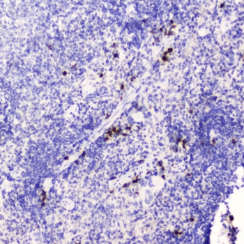 HE4 Antibody Mouse Spleen IHC. Immunohistochemistry was performed on FFPE mouse spleen tissue using HE4 Antibody at 0.5 ug/mL. Heat-induced epitope retrieval was carried out in pH 6 citrate buffer for 10-20 minutes, followed by cooling to room temperature before incubation with the primary antibody. Bound antibody was visualized using an HRP-conjugated secondary antibody and DAB chromogen. Distinct staining is observed in scattered splenic cells, while most surrounding lymphoid tissue remains negative, indicating selective HE4 expression with minimal background. These findings demonstrate that this Human Epididymis Protein 4 Antibody is suitable for immunohistochemical detection of HE4 in formalin-fixed, paraffin-embedded mouse tissue.