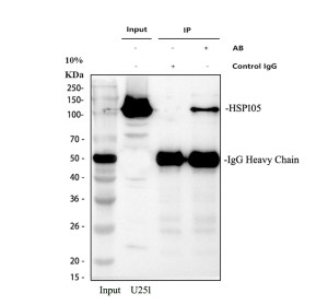 HSP105 Antibody Human U251 Glioblastoma Cell Immunoprecipitation. Immunoprecipitation of HSP105 was performed from human U251 glioblastoma whole cell lysate using HSP105 Antibody, also called Heat Shock Protein 105 Antibody. Lane 1: 30 ug of U251 input lysate; Lane 2: material immunoprecipitated with rabbit control IgG; Lane 3: material immunoprecipitated with 2 ug of HSP105 Antibody from 500 ug of U251 lysate. Western blot detection was performed with HSP105 Antibody at 0.5 ug/ml followed by HRP-conjugated secondary antibody and ECL detection. HSP105/HSPH1 is detected at approximately 105 kDa, near the expected molecular weight of approximately 97 kDa, demonstrating successful immunoprecipitation of Heat Shock Protein 105 from human U251 cells.