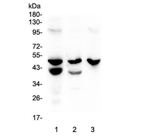 Western blot testing of 1) rat stomach, 2) mouse stomach and 3) mouse SP2/0 lysate with Cathepsin E antibody at 0.5ug/ml. Predicted molecular weight ~43 kDa.