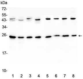 Western blot testing of 1) rat brain, 2) rat lung, 3) mouse brain, 4) mouse lung and human 5) HeLa, 6) placenta, 7) MCF7 and 8) HepG2 lystate with IL36A antibody at 0.5ug/ml. Predicted molecular weight ~17 kDa, routinely observed at 18-22 kDa.