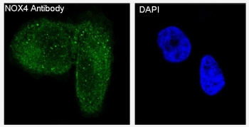NOX4 Antibody HeLa Cell IF. Immunofluorescence was performed on human HeLa cells using NOX4 Antibody (green) with DAPI as a nuclear counterstain (blue). Distinct cytoplasmic staining with a punctate intracellular distribution is observed, while nuclei remain DAPI-positive and largely negative for NOX4 immunoreactivity. The staining pattern is consistent with the intracellular localization of NOX4 within membrane-associated organelles involved in reactive oxygen species generation. These results demonstrate that this Hydrogen Peroxide Producing Enzyme Antibody is suitable for immunofluorescent detection of endogenous NOX4 in human HeLa cells.