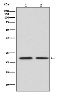 Western blot testing of 1) human HeLa and 2) mouse spleen lysate with FGF21 antibody at 0.5ug/ml. Predicted molecular weight ~21 kDa.