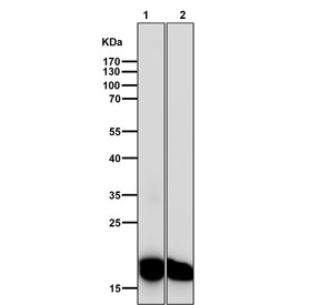 Western blot testing of 1) mouse skin and 2) rat skin tissue lysate with CEBPB antibody. Expected molecular weight: 36-41 kDa and ~16 kDa (LIP isoform).