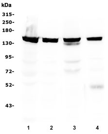 Western blot testing of 1) human HeLa, 2) human HEK293, 3) rat thymus and 4) mouse thymus lysate with SMC3 antibody at 0.5ug/ml. Predicted molecular weight ~141 kDa.