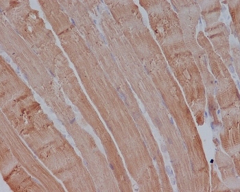 IHC testing of FFPE mouse muscle with Alpha Actin antibody at 2ug/ml. HIER: boil tissue sections in pH6, 10mM citrate buffer, for 10-20 min followed by cooling at RT for 20 min.