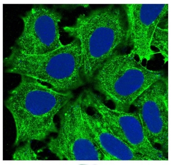 Immunofluorescent staining of human HeLa cells with Alpha Actin antibody (green) and DAPI nuclear stain (blue).