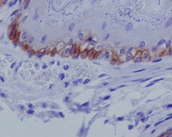 IHC testing of FFPE mouse skin with Collagen XVII antibody at 2ug/ml. HIER: boil tissue sections in pH6, 10mM citrate buffer, for 10-20 min followed by cooling at RT for 20 min.